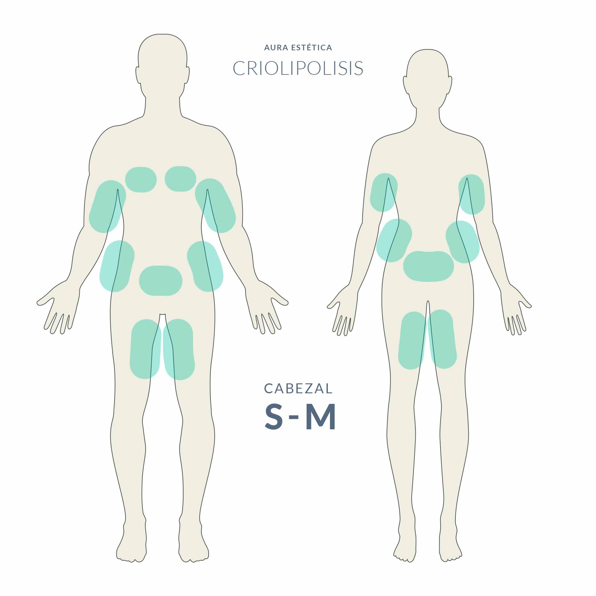 Criolipólisis reductiva