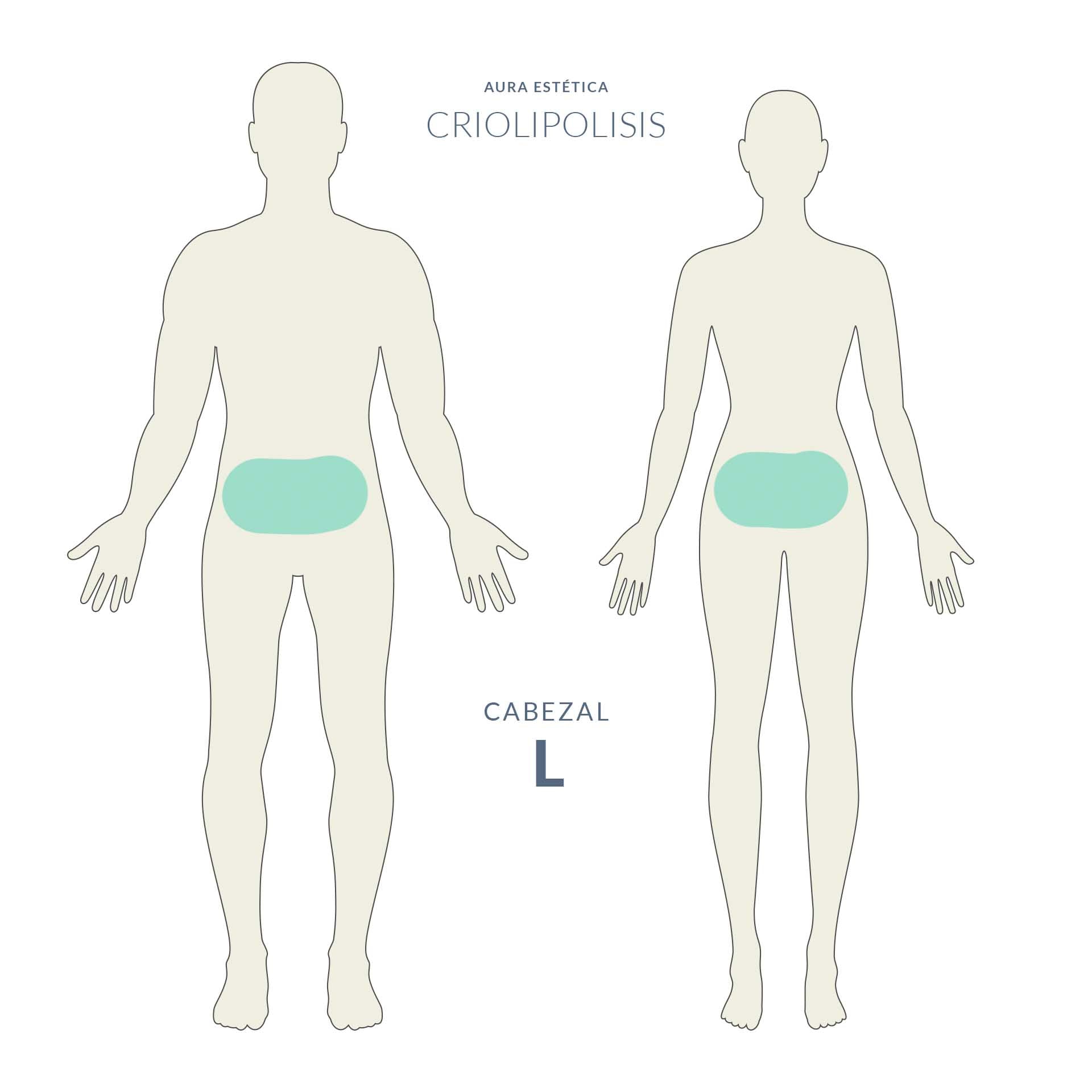 Criolipólisis reductiva